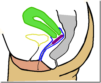 Placement of Tampon inside the Vagina