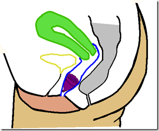 Placement of a Menstrual Cup inside the Vagina